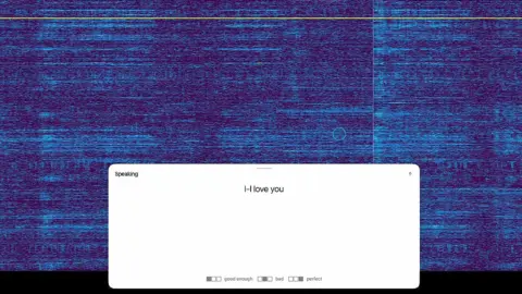 Neuralink N1 Implant Reconstructs ALS Patient’s Original Voice From Brainwaves